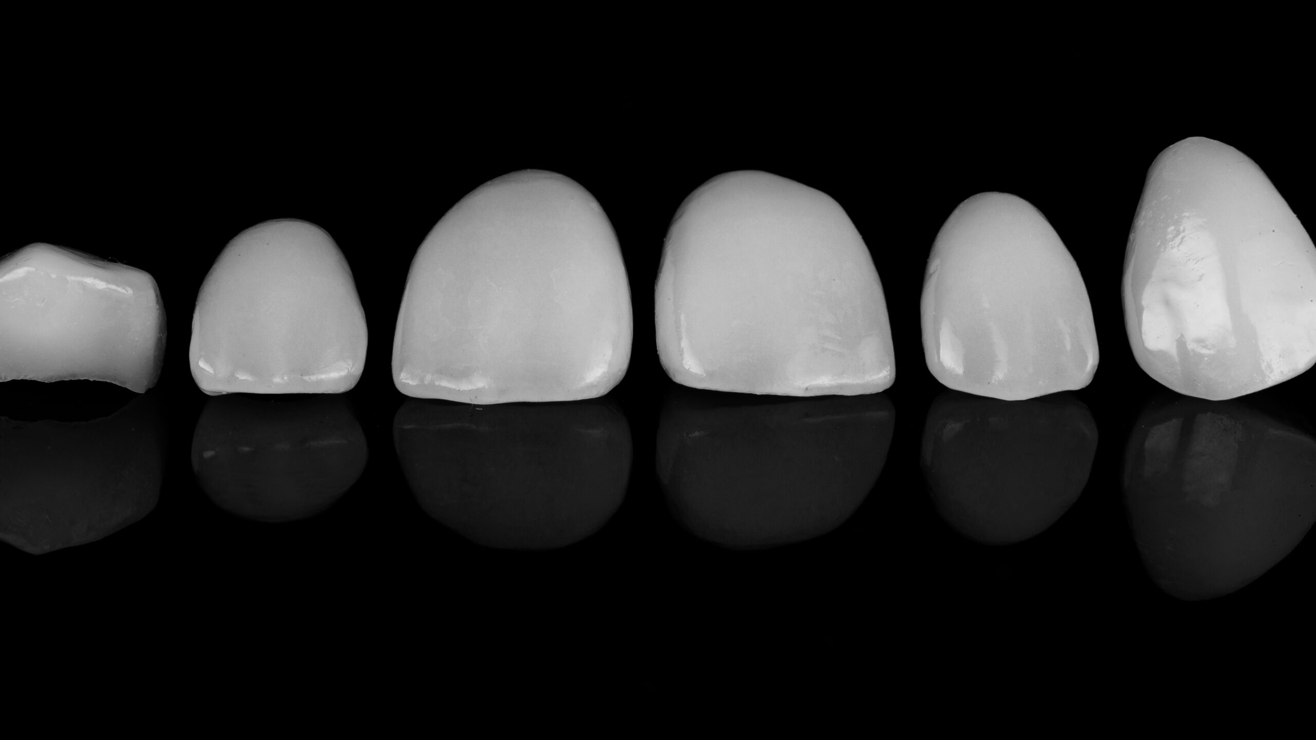 Types of dental veneers