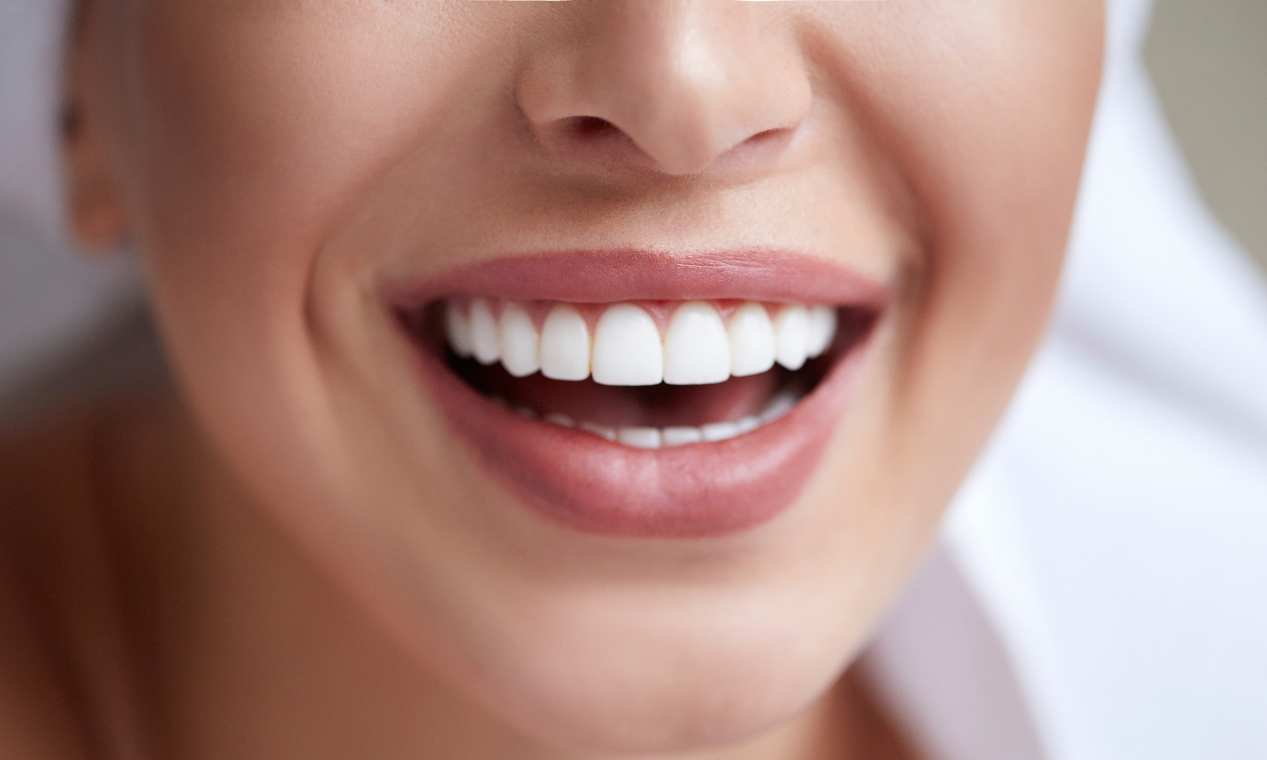 Transform Your Smile with Professional Teeth Whitening in Marion
