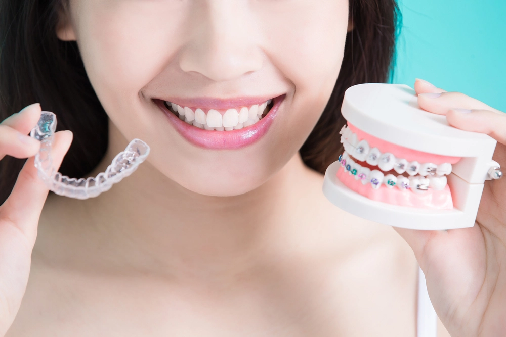 Clear Aligners vs. Braces – Which Option Is Right for You?