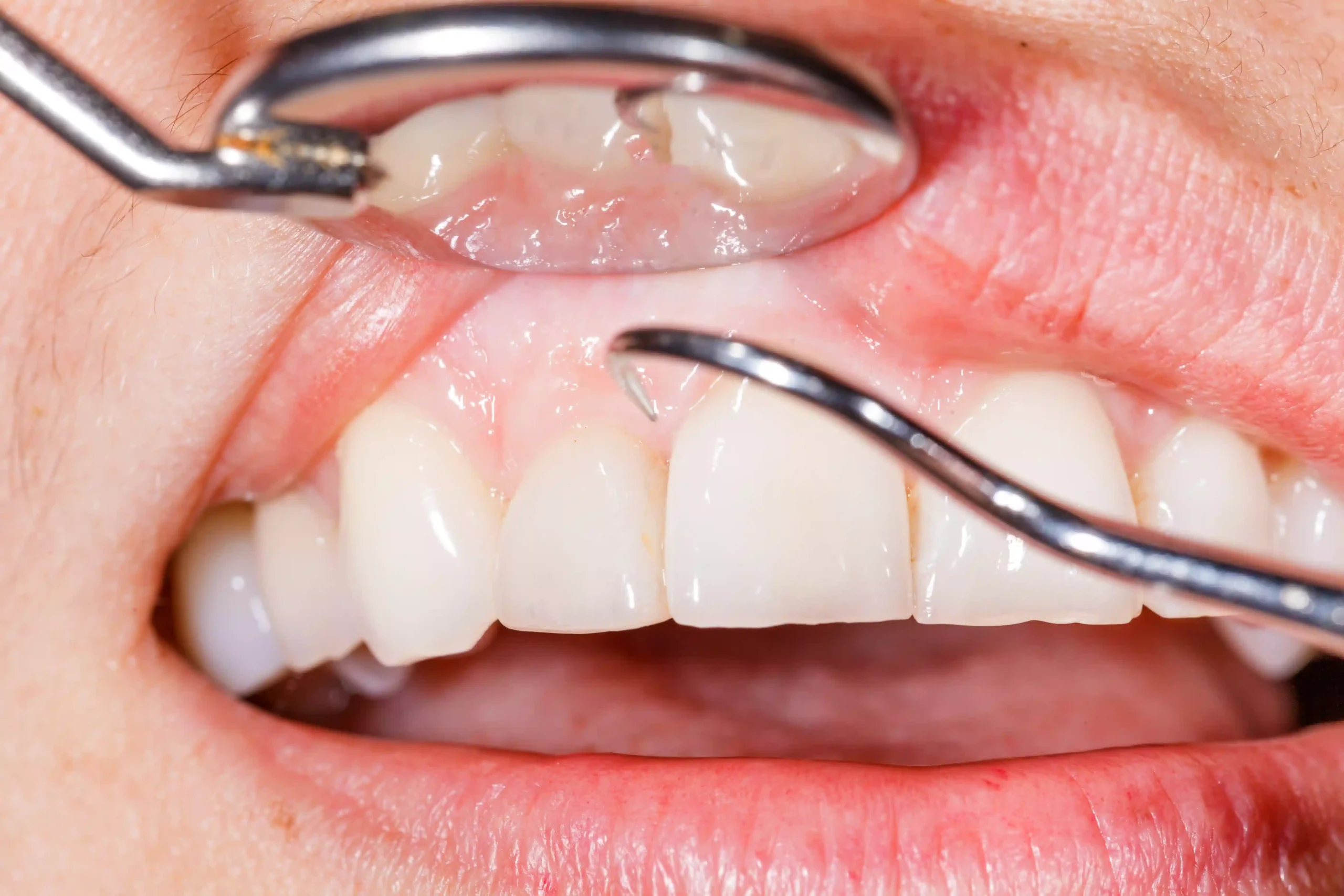How Regular Dental Check-Ups Help Prevent Costly Dental Problems