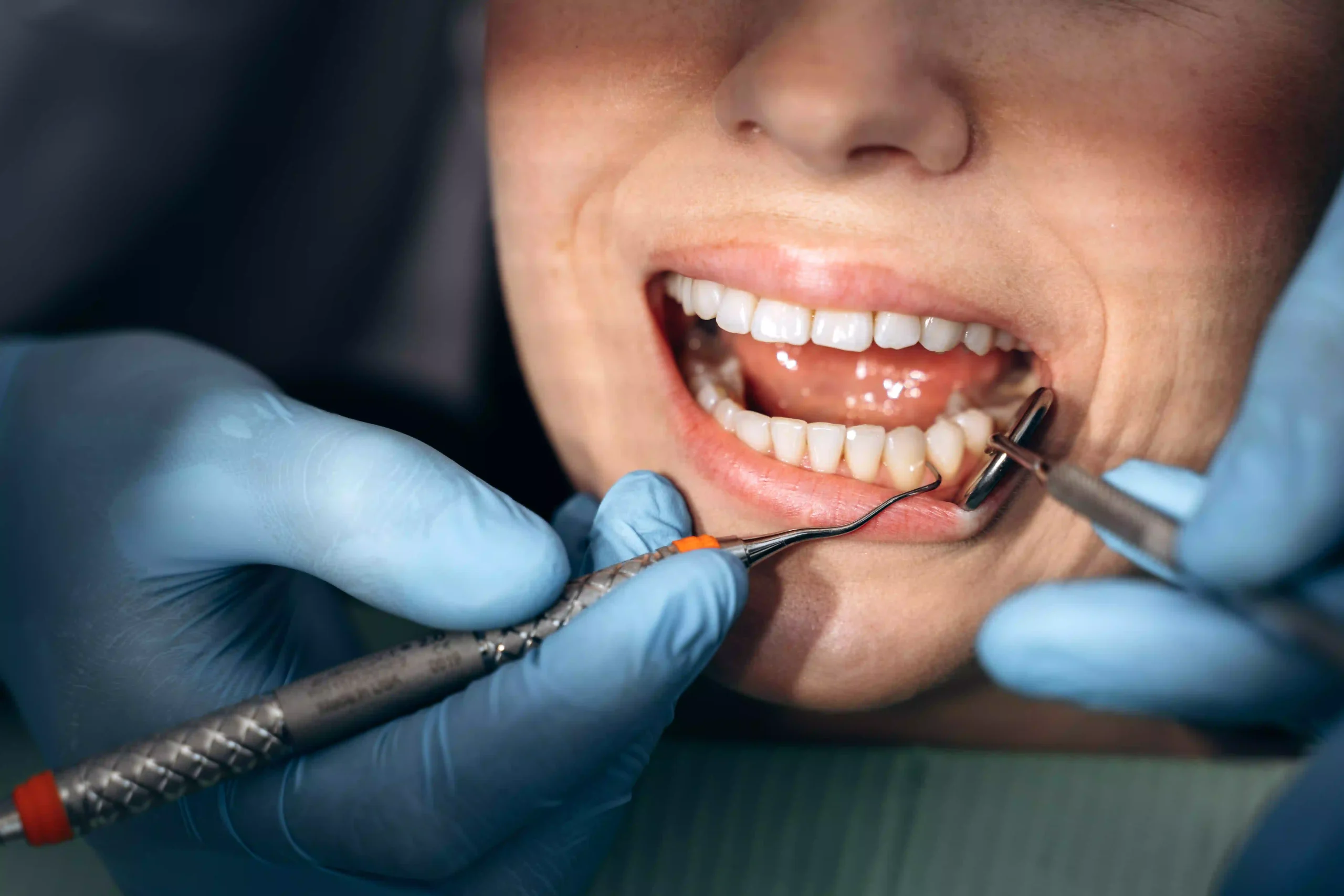 The Importance of Preventive Dentistry for Long-Term Oral Health