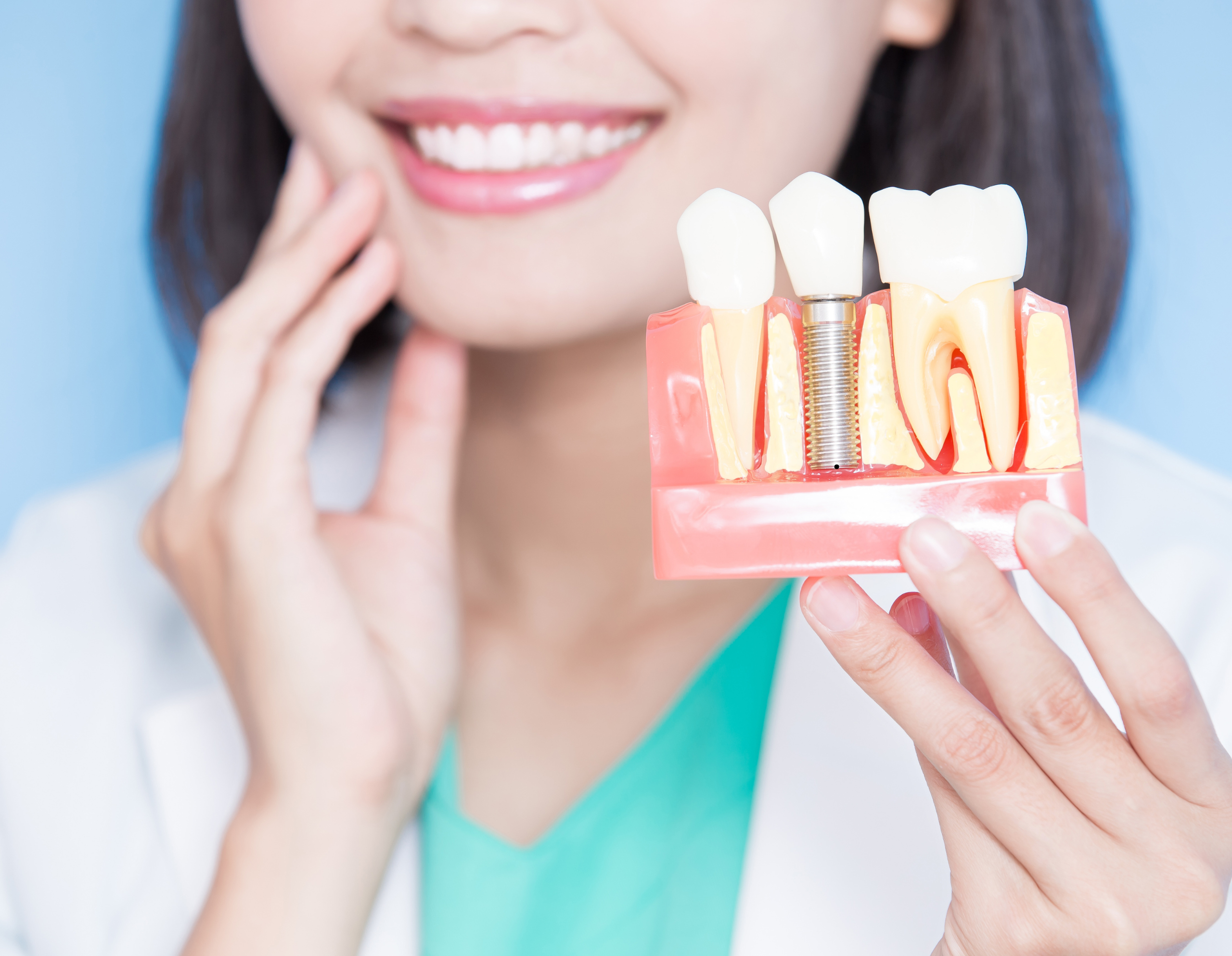 Dental Implants in Marion SA: Everything You Need to Know Before Replacing Missing Teeth