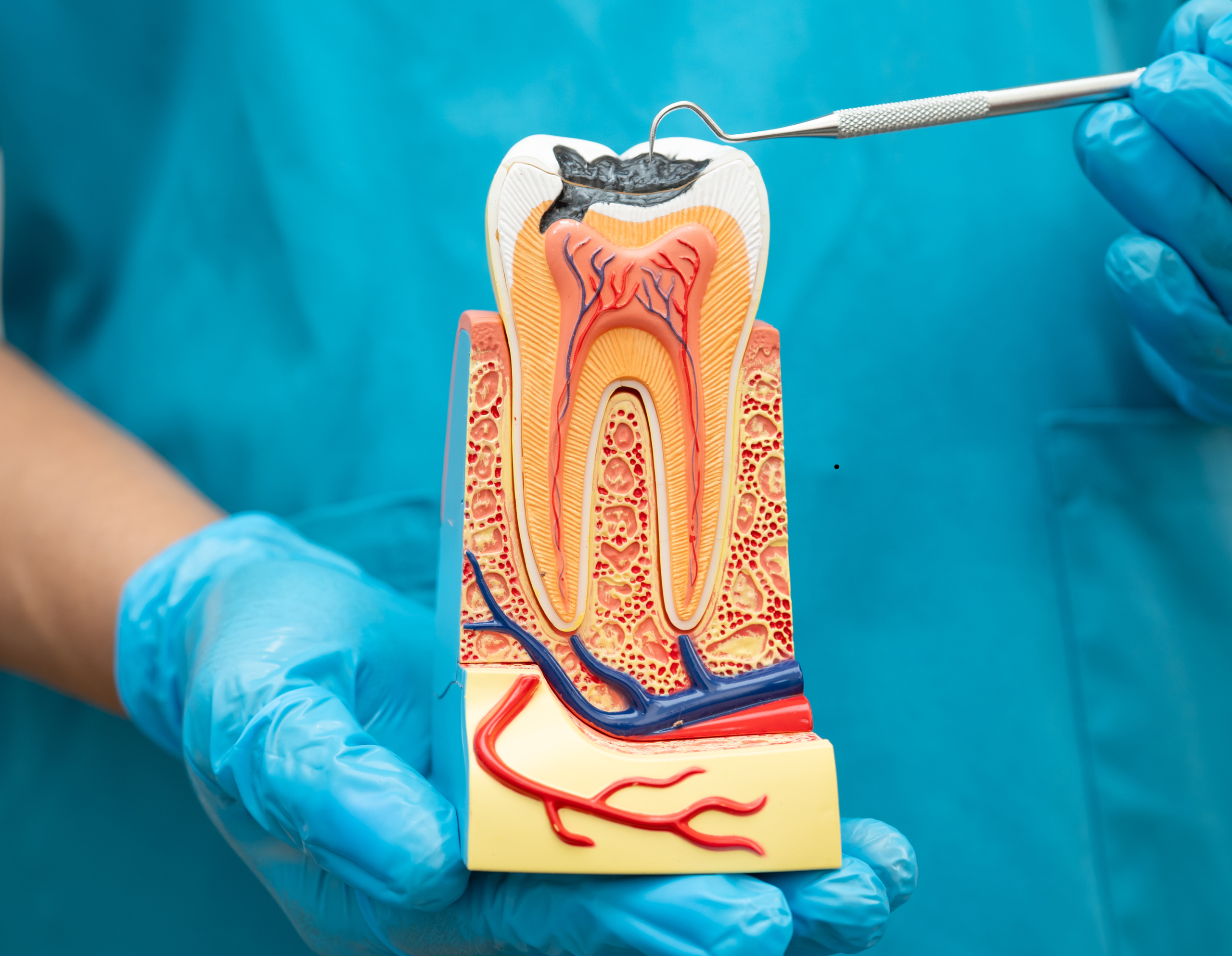 Root Canal Treatment in Marion SA: When Can It Save Your Natural Tooth?