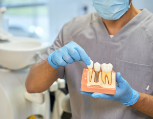 Dental Implants in Marion SA: What You Should Know Before Replacing a Missing Tooth