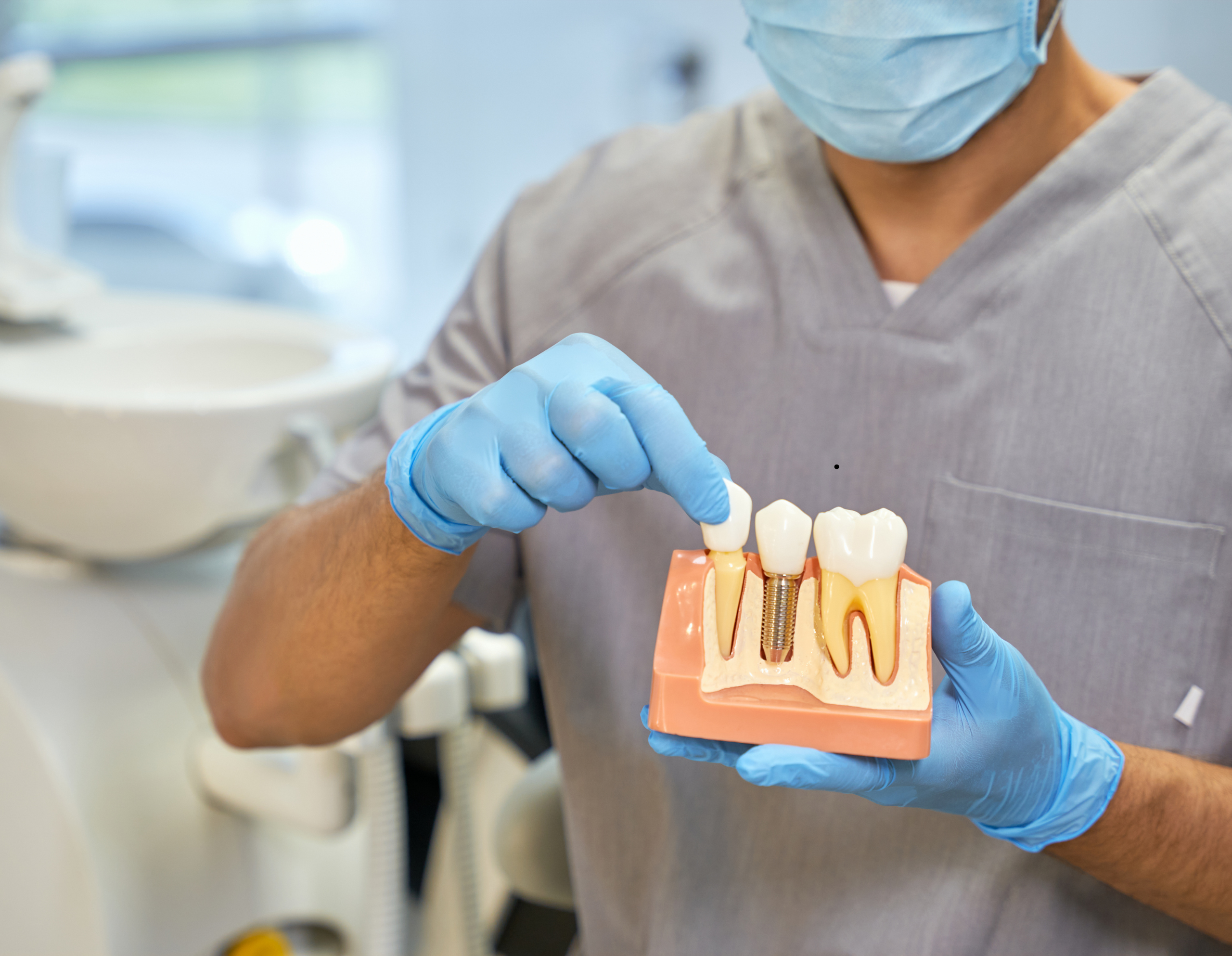 Dental Implants in Marion SA: What You Should Know Before Replacing a Missing Tooth